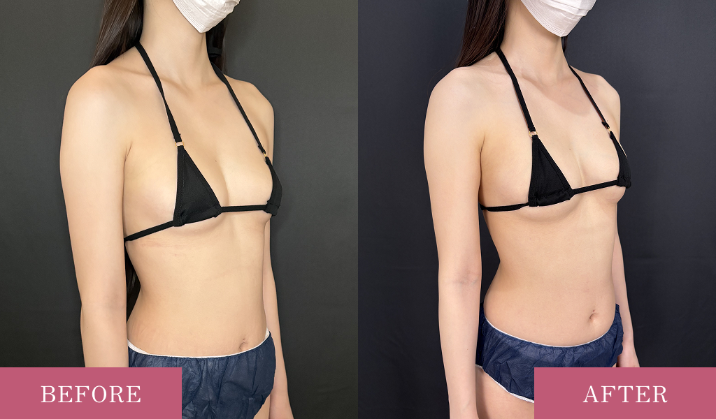 自然な仕上がりへのこだわり