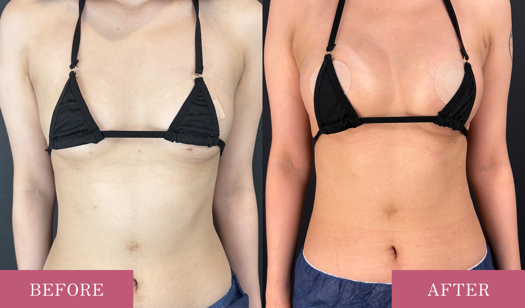 自然な仕上がりへのこだわり