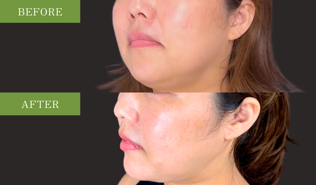 自然な仕上がりへのこだわり